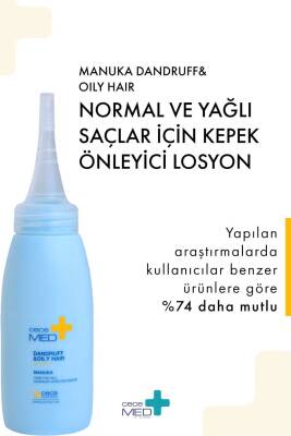 Kepek Karşıtı Manuka Losyon - Dandruff Oily Hair Lotion 75 ml - 5