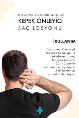 Kepek Karşıtı Manuka Losyon - Dandruff Oily Hair Lotion 75 ml - 6