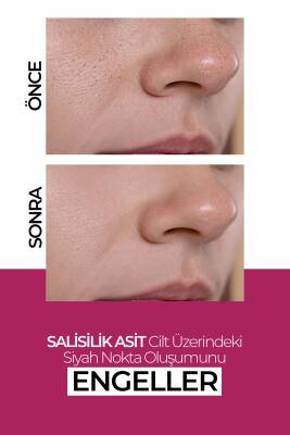 Nemlendirici Cilt Yenileyici Leke Karşıtı Krem 50ML - 2