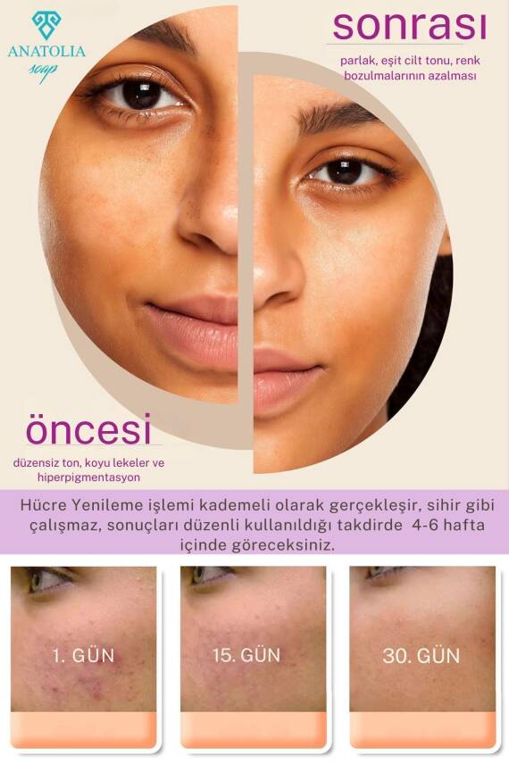 Retinage Kırışıklık Karşıtı, Onarıcı Ceramide A Vitamini Yaşlanma Karşıtı Üzüm Retinol Sabunu - 2